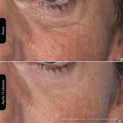 ByMalina Masque Clinique