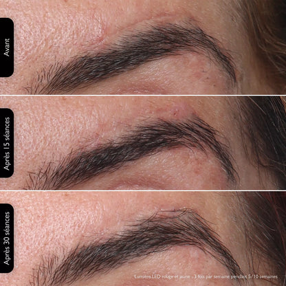 ByMalina Masque Clinique