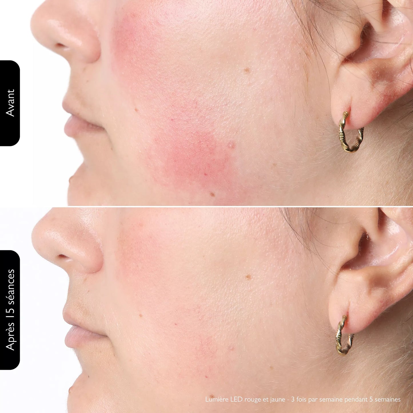 ByMalina Masque Clinique