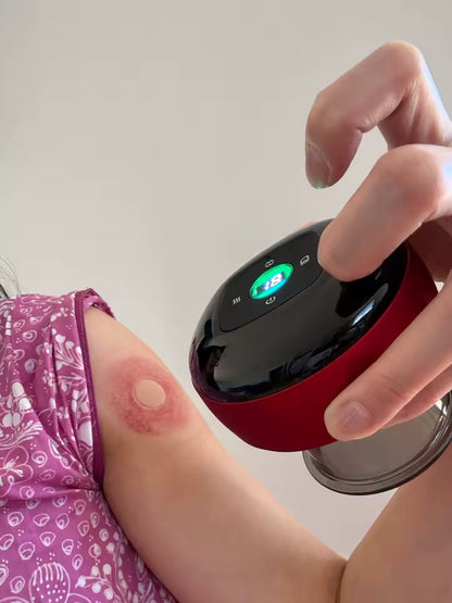 Appareil de Massage par Ventouses