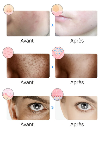 ByMalina Masque Clinique